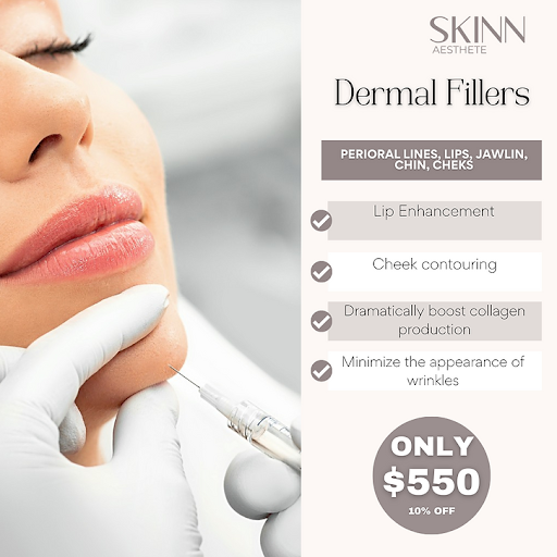 Burbank Dermal fillers for lip and cheek enhancement promotion.